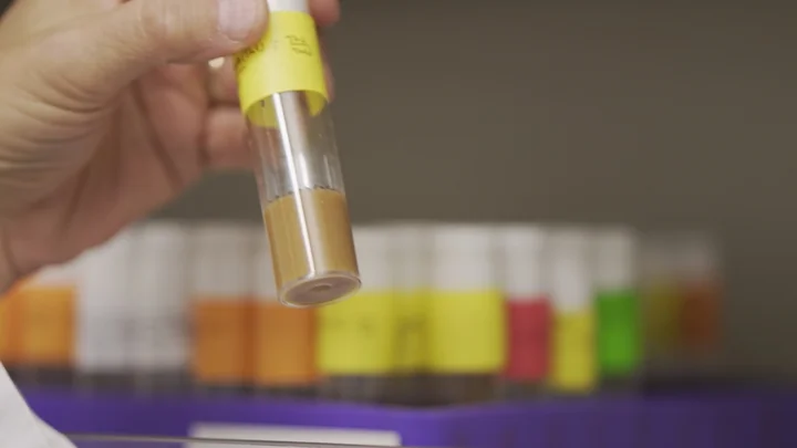 Lab sample (Zipursky Lab) 